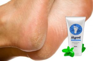MyCeril – Bio-Fußcreme mit Formel gegen Pilze und Bakterien!
