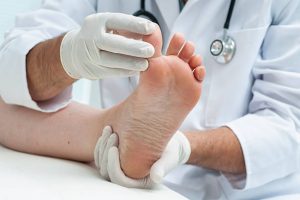 Pilzinfektion an den Füßen – Symptome und Behandlung