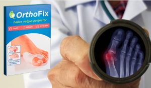 OrthoFix Fixator für Hallux Valgus – Hilft es bei Konvexenknochen?