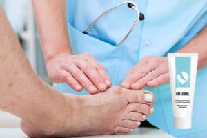 Halluxeal Bewertung – Natürliche Fußcreme zur Schmerzlinderung und effektiven Entfernung von Hallux Valgus